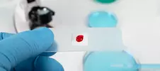 врач проводит общеклинические анализы крови